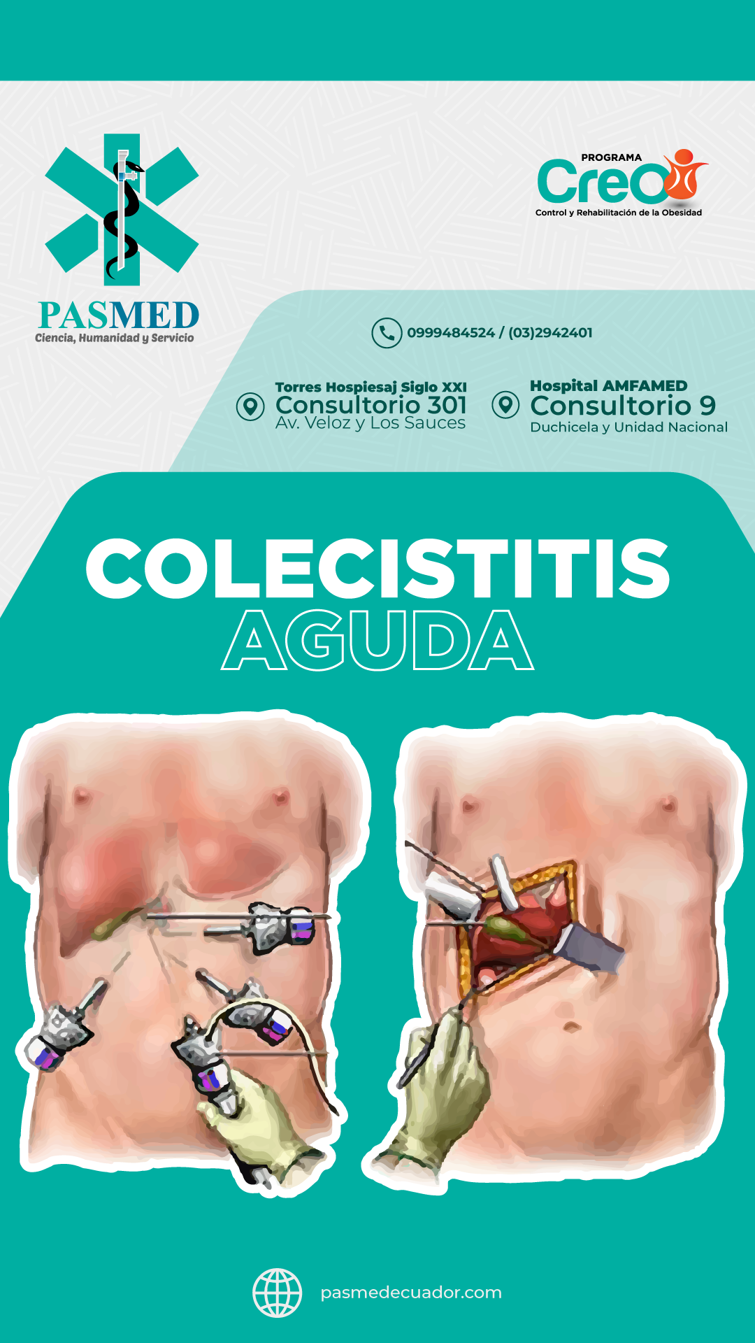 Colecistitis Aguda - PASMED Cirugía General en Riobamba